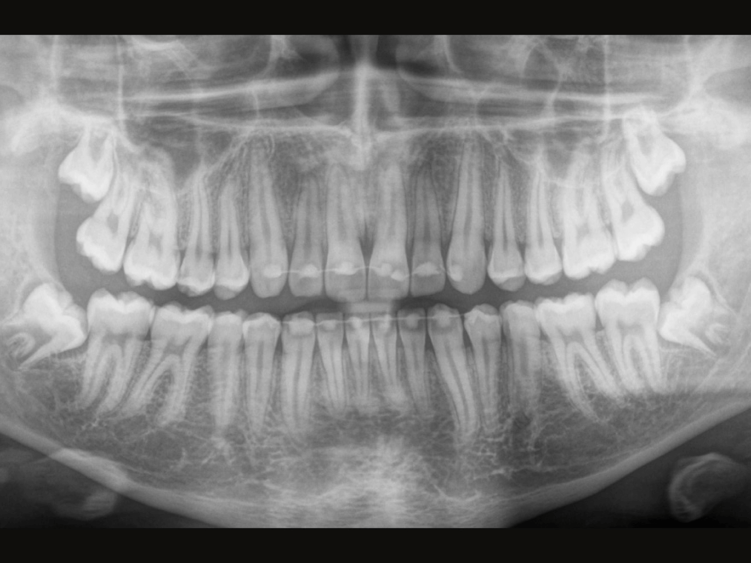 sirona-orthophos-s-3d-aufnahme